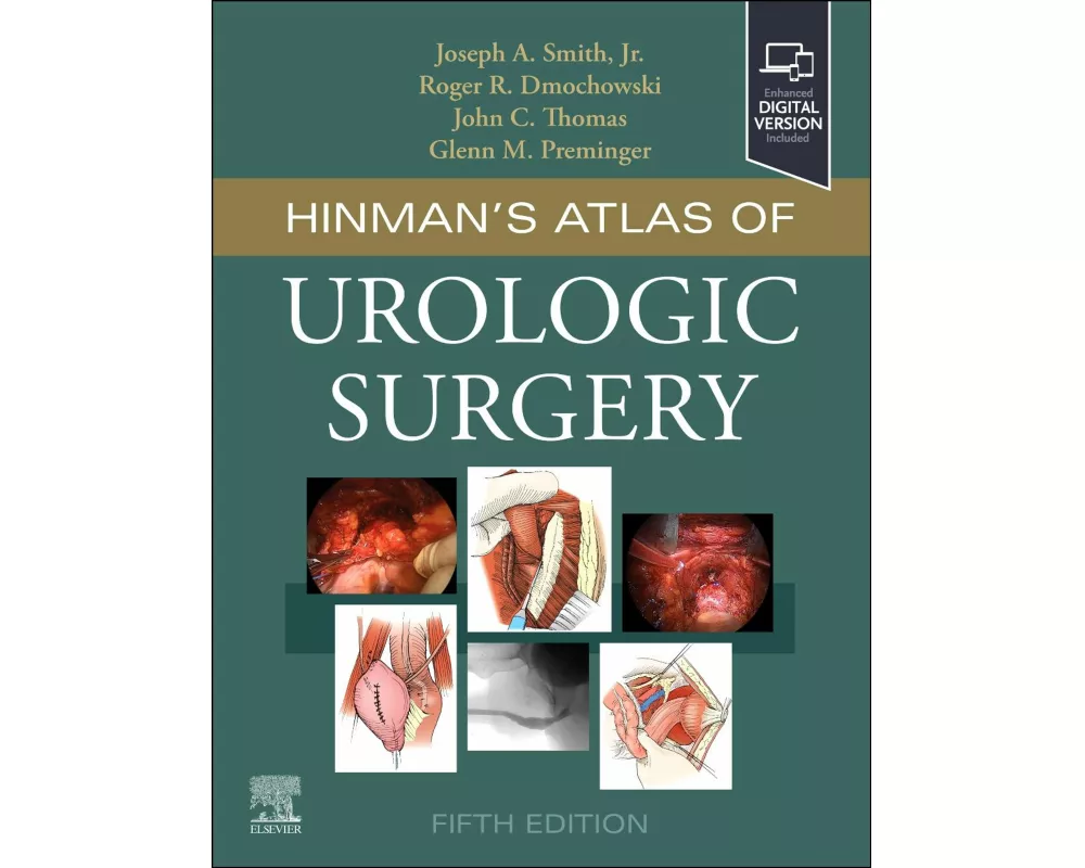 Hinman's Atlas of Urologic Surgery