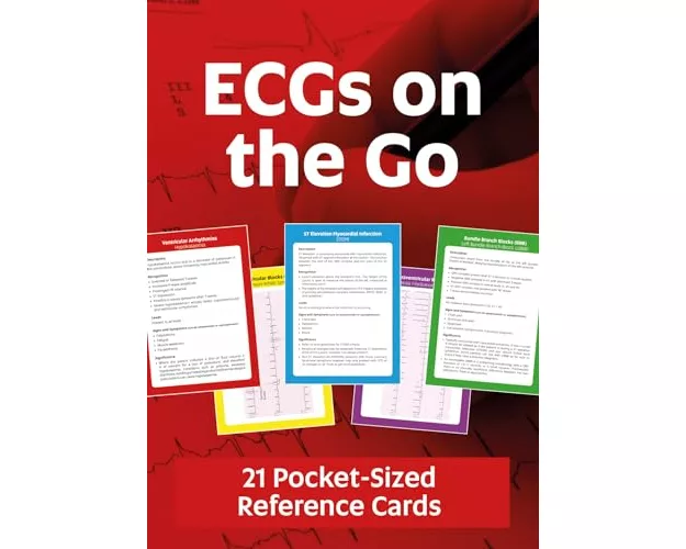 ECGs On The Go