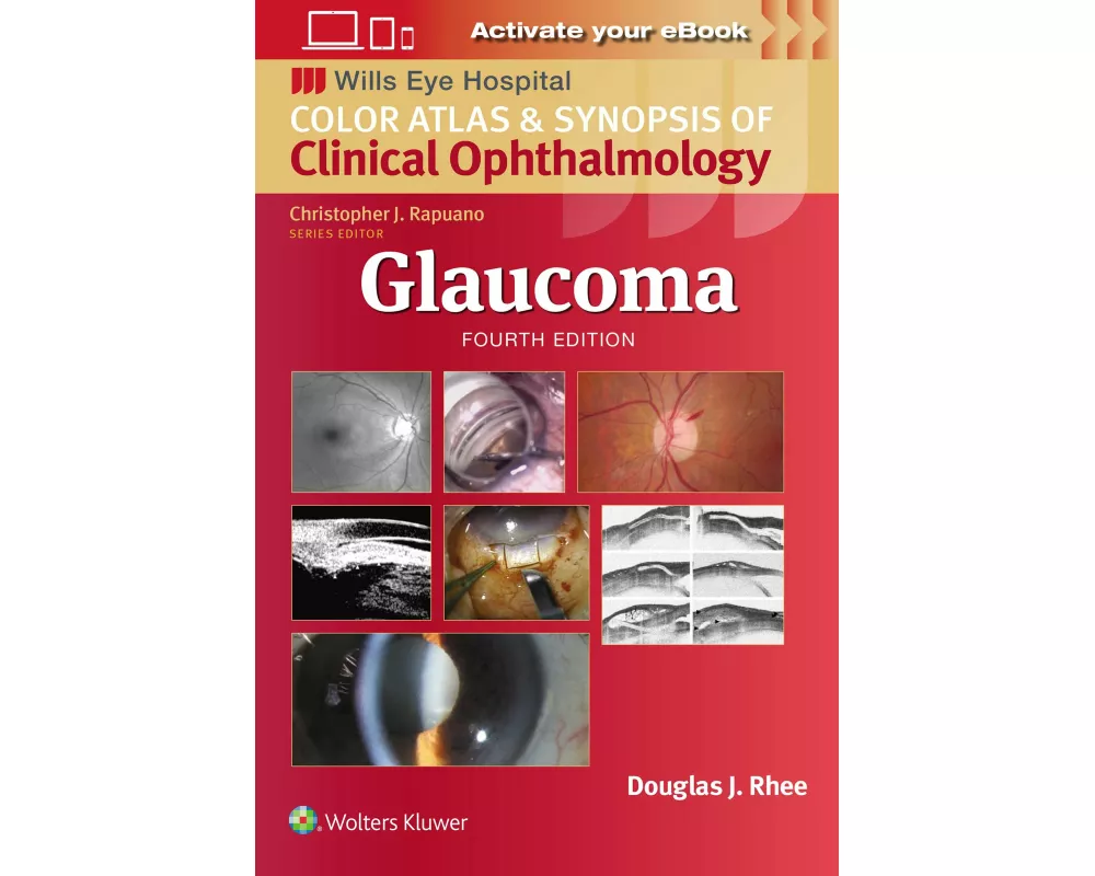 Glaucoma