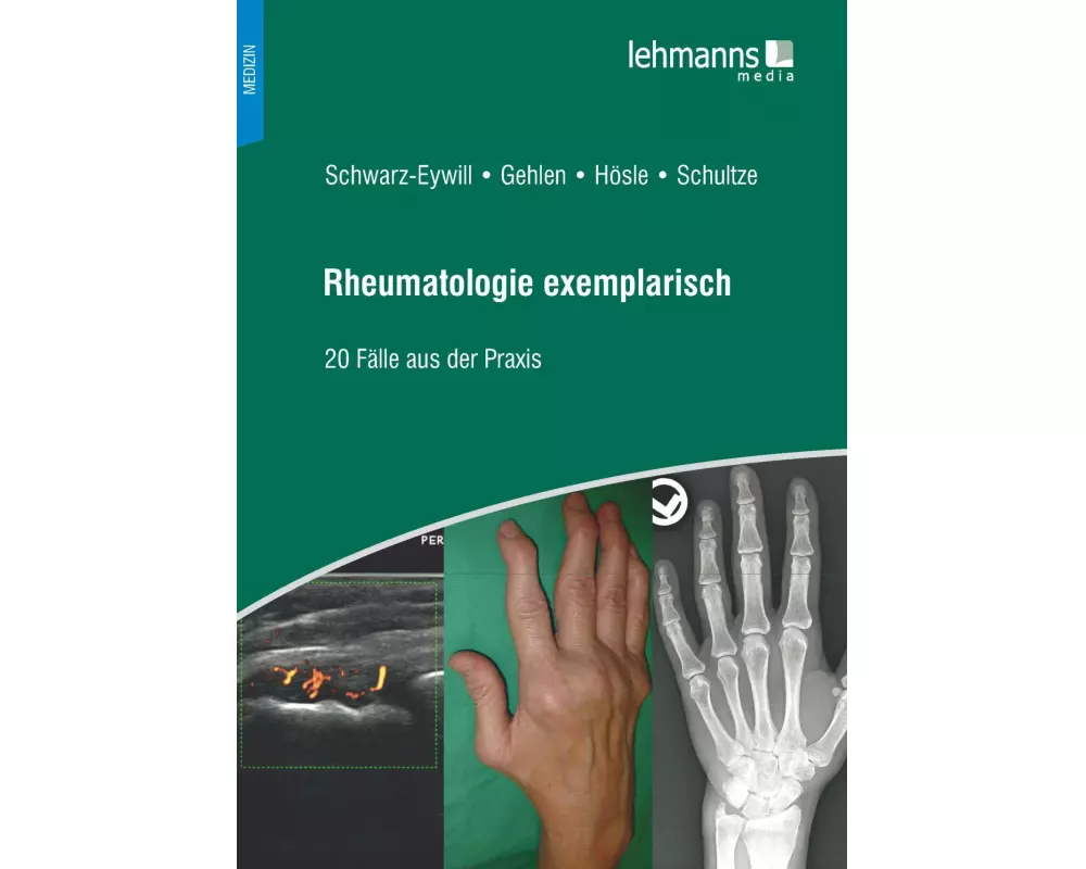 Rheumatologie exemplarisch