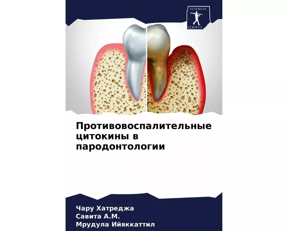 Protiwowospalitel'nye citokiny w parodontologii