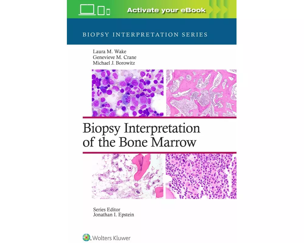 Biopsy Interpretation of the Bone Marrow: Print + eBook with Multimedia