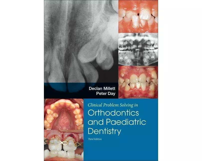 Clinical Problem Solving in Dentistry: Orthodontics and Paediatric Dentistry
