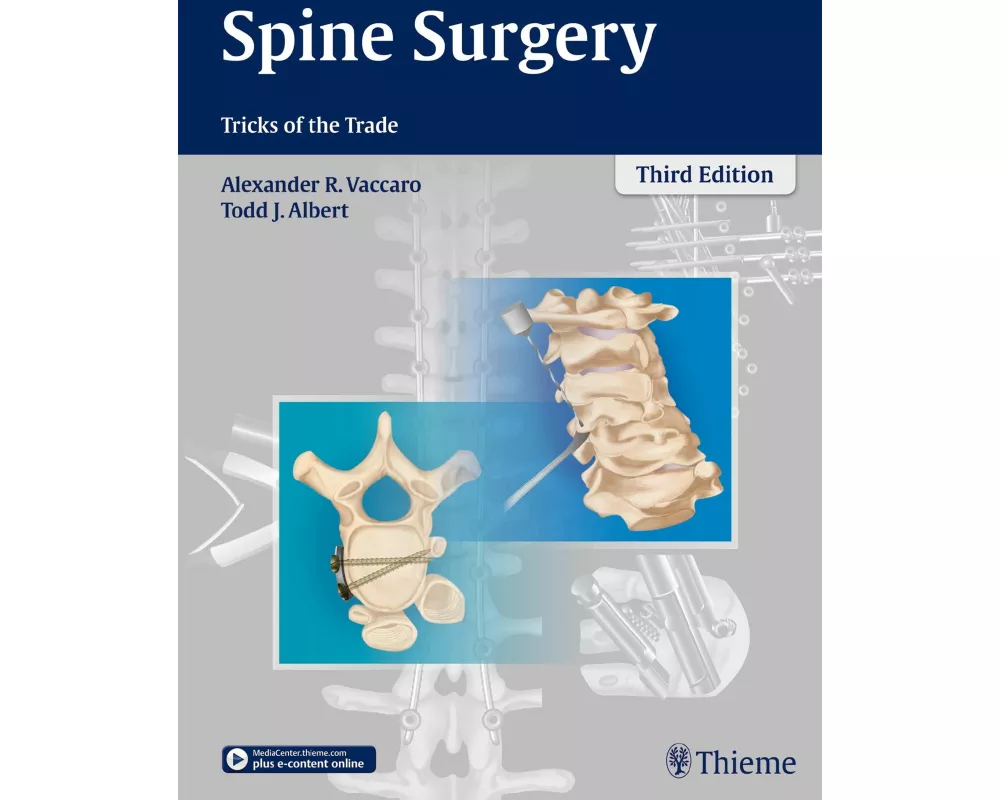 Spine Surgery