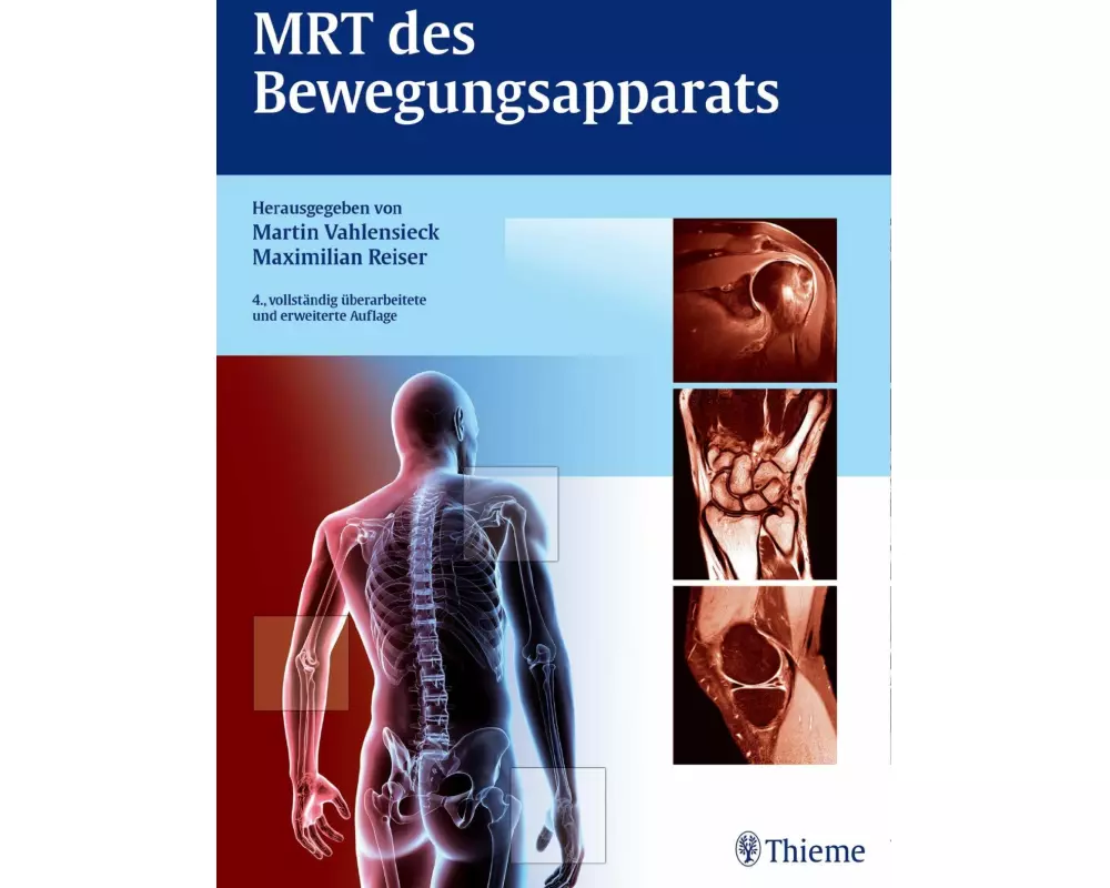 MRT des Bewegungsapparats