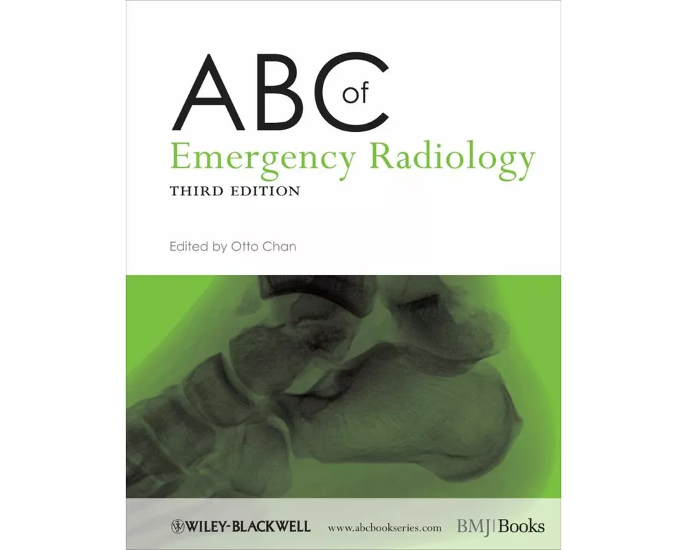 ABC of Emergency Radiology