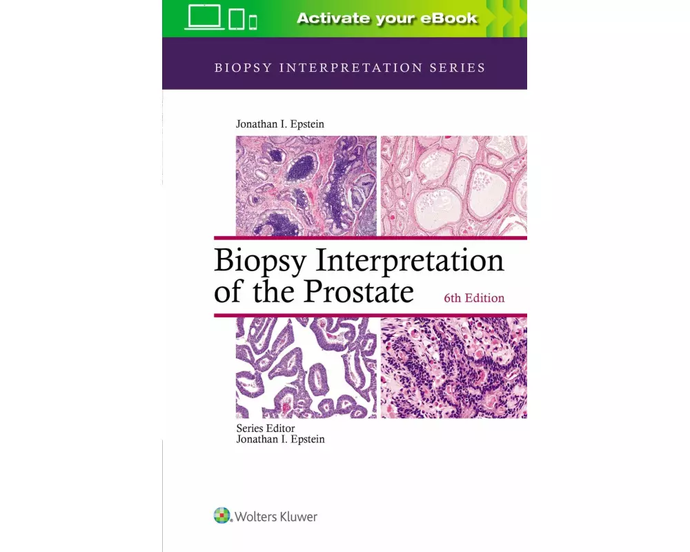 Biopsy Interpretation of the Prostate