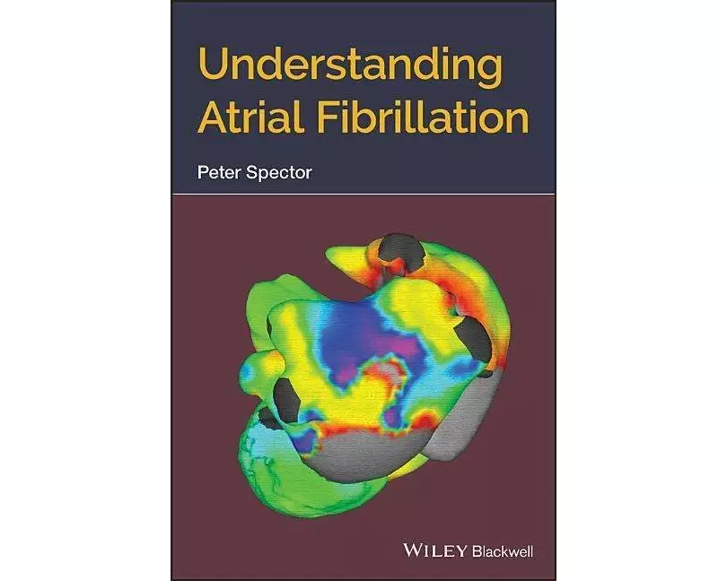 Understanding Atrial Fibrillation