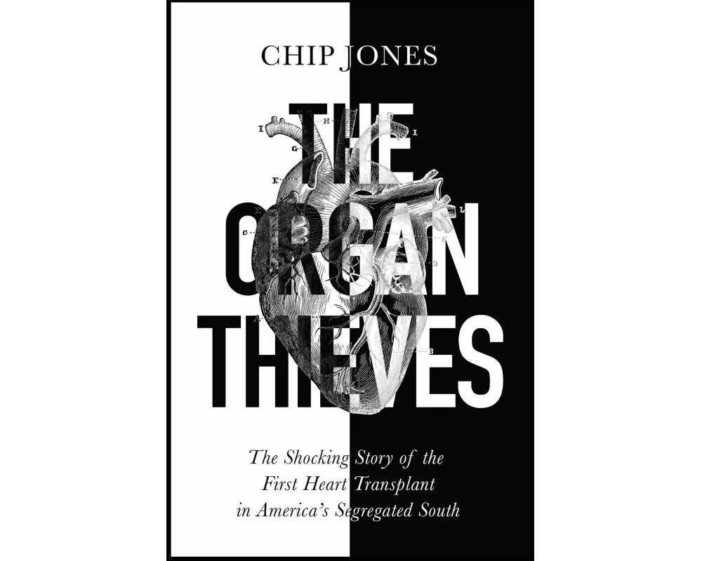 The Organ Thieves