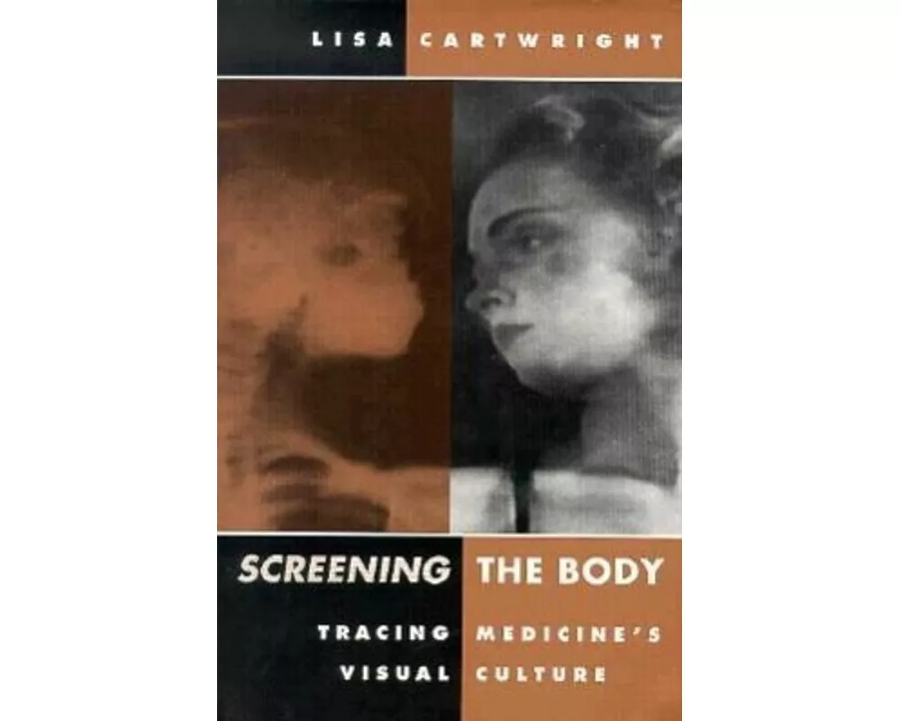 Screening the Body