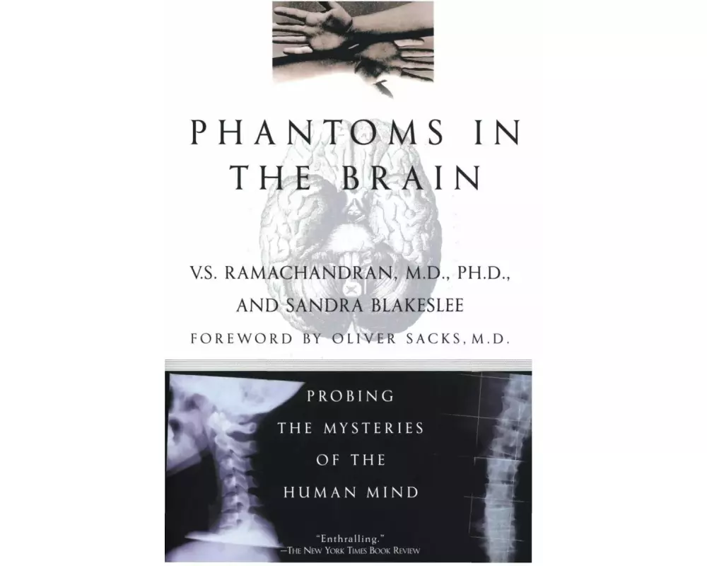 Phantoms in the Brain