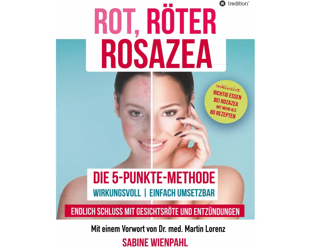 Rot RÖter Rosazea