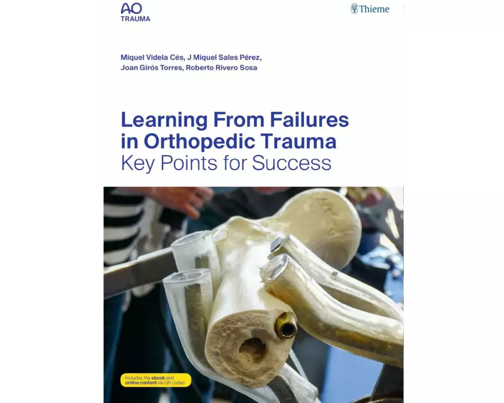 Learning from Failures in Orthopedic Trauma