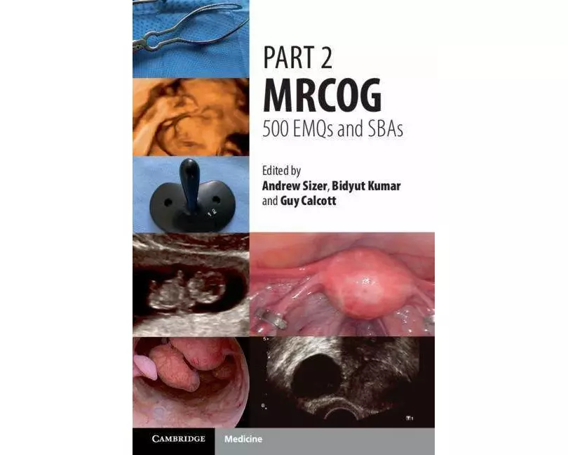 Part 2 MRCOG: 500 EMQs and SBAs