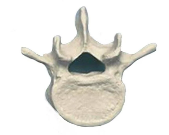 Rüdiger Skelett Lendenwirbel einzeln