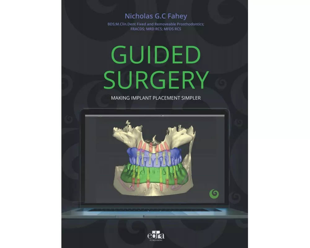 Guided Surgery