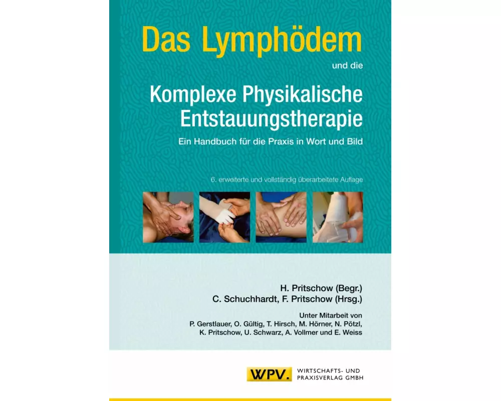 Das Lymphödem und die Komplexe Physikalische Entstauungstherapie