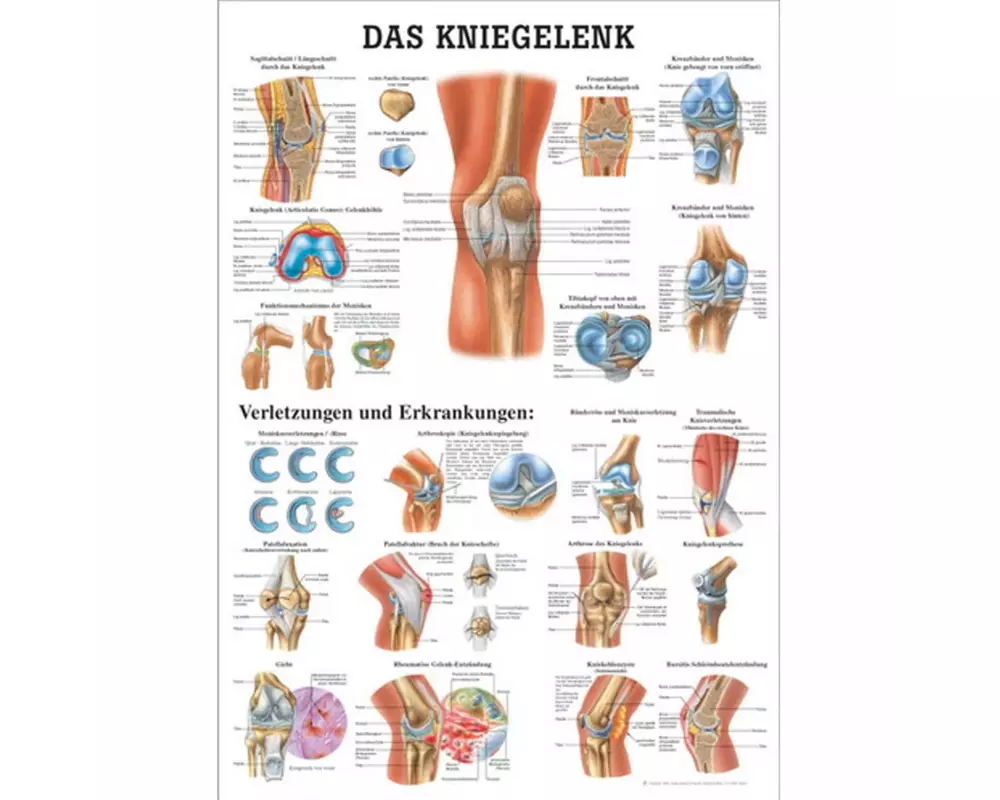 Rüdiger Anatomische Lehrtafel Das Kniegelenk 70 x 100 cm