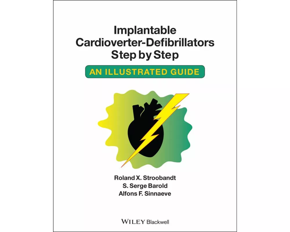 Implantable Cardioverter - Defibrillators Step by Step