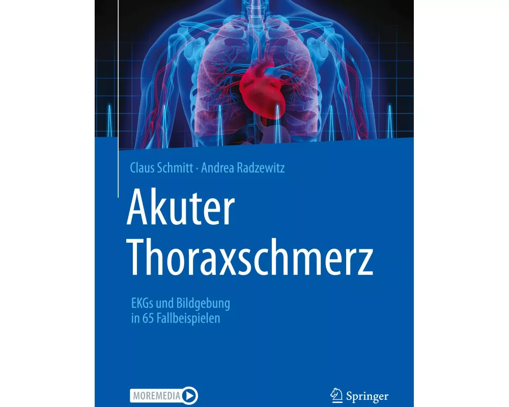 Akuter Thoraxschmerz
