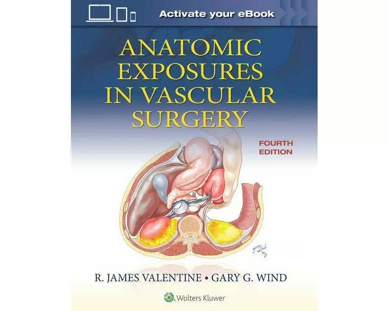 Anatomic Exposures in Vascular Surgery