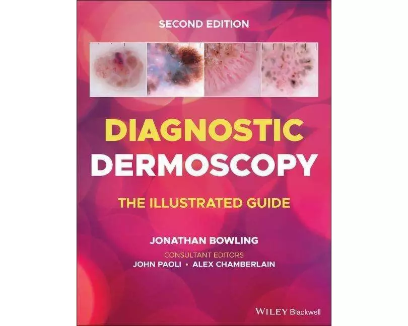 Diagnostic Dermoscopy