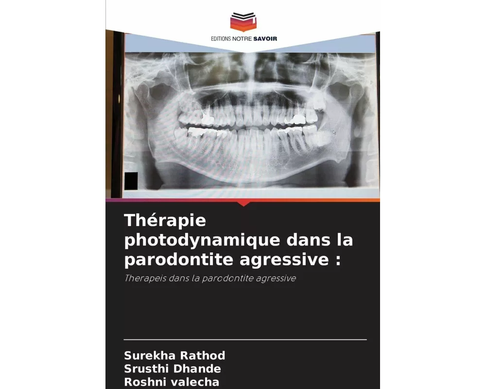 Thérapie photodynamique dans la parodontite agressive
