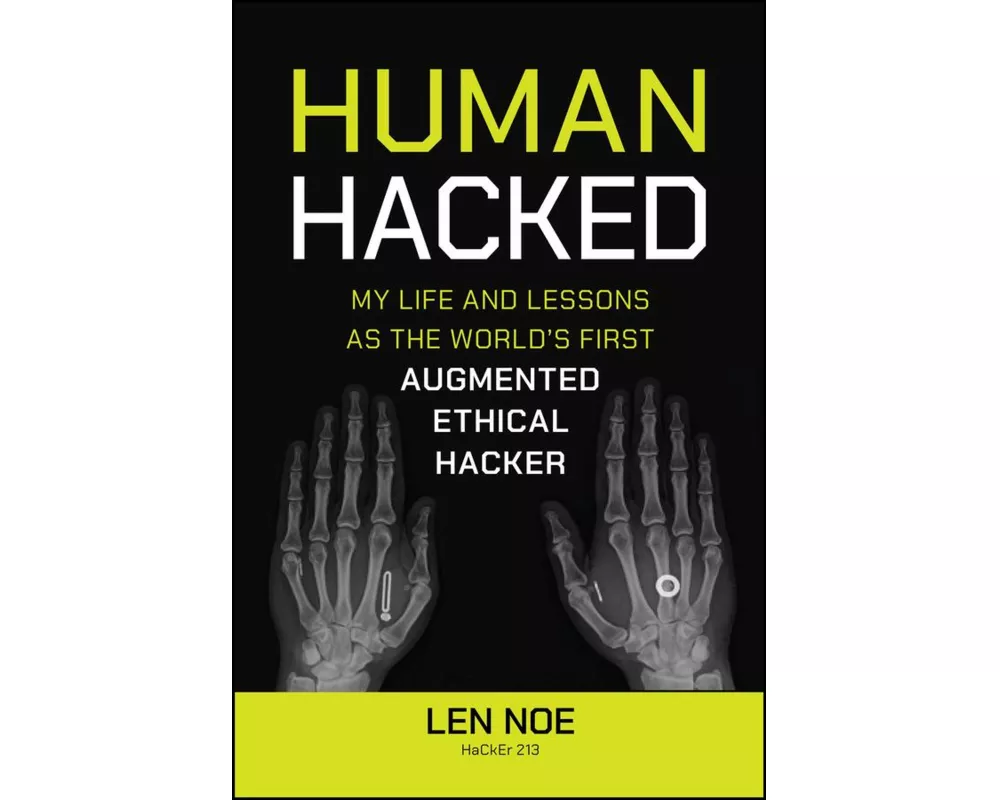 Human Hacked