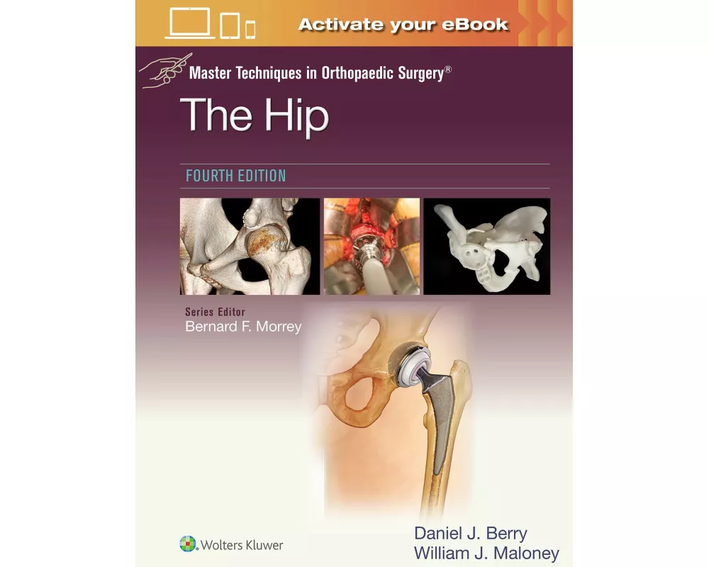 Master Techniques in Orthopaedic Surgery: The Hip: Print + eBook with Multimedia