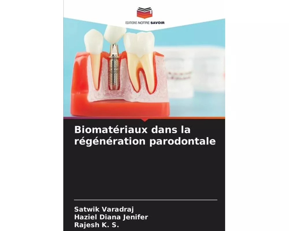 Biomatériaux dans la régénération parodontale