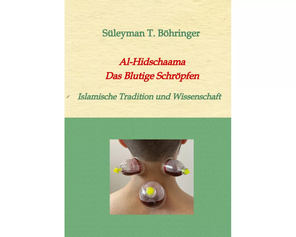 Al-Hidschaama Das Blutige Schröpfen
