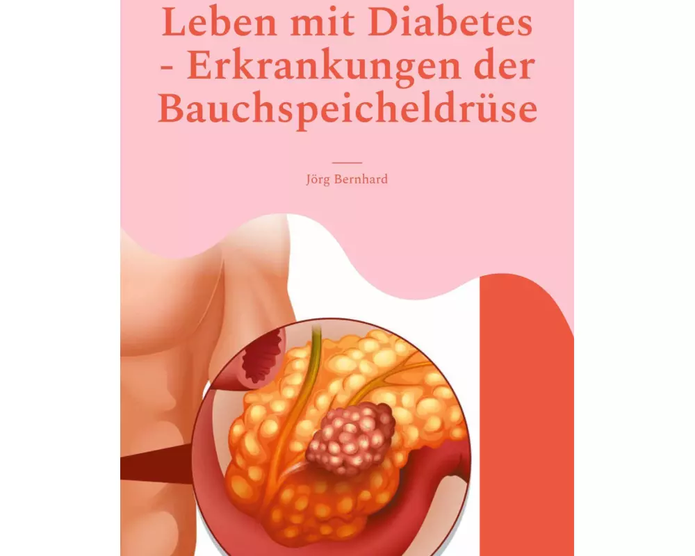 Leben mit Diabetes - Erkrankungen der Bauchspeicheldrüse