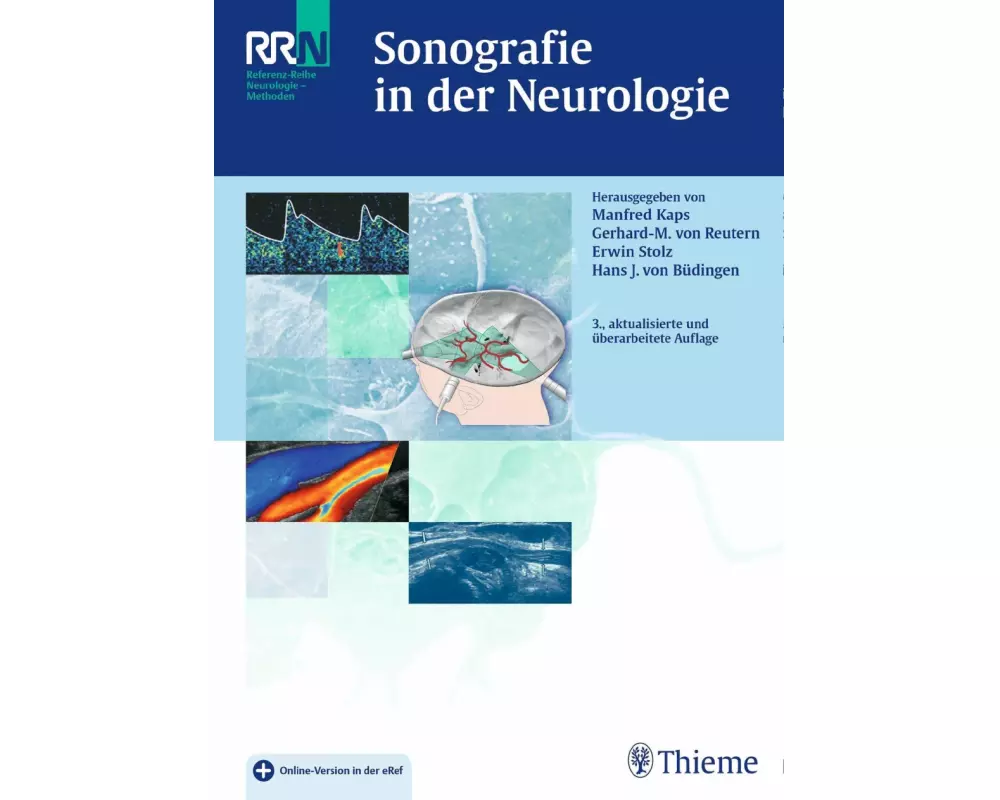 Sonografie in der Neurologie