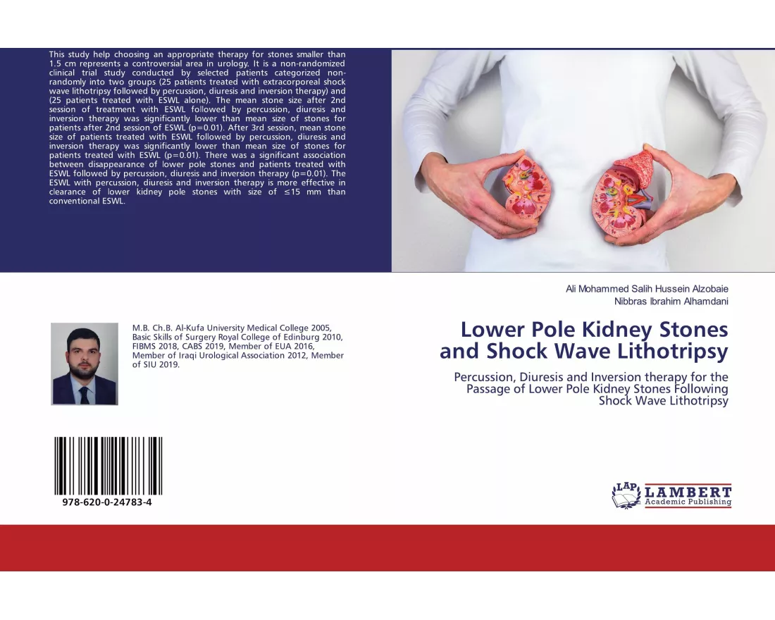 Lower Pole Kidney Stones and Shock Wave Lithotripsy