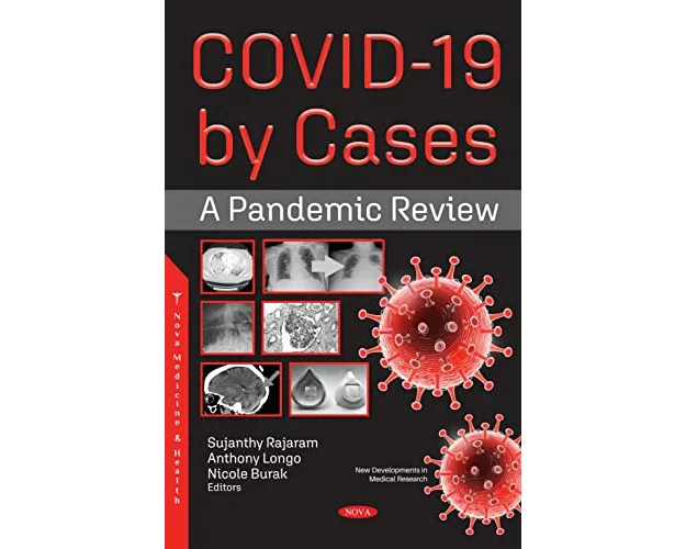 COVID-19 by Cases