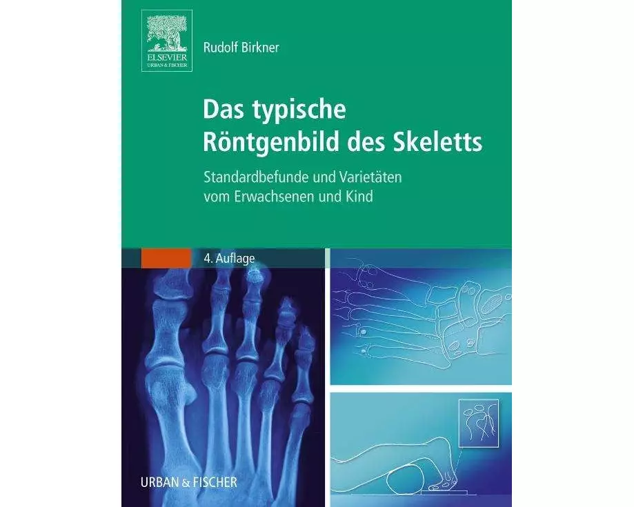 Das typische Röntgenbild des Skeletts