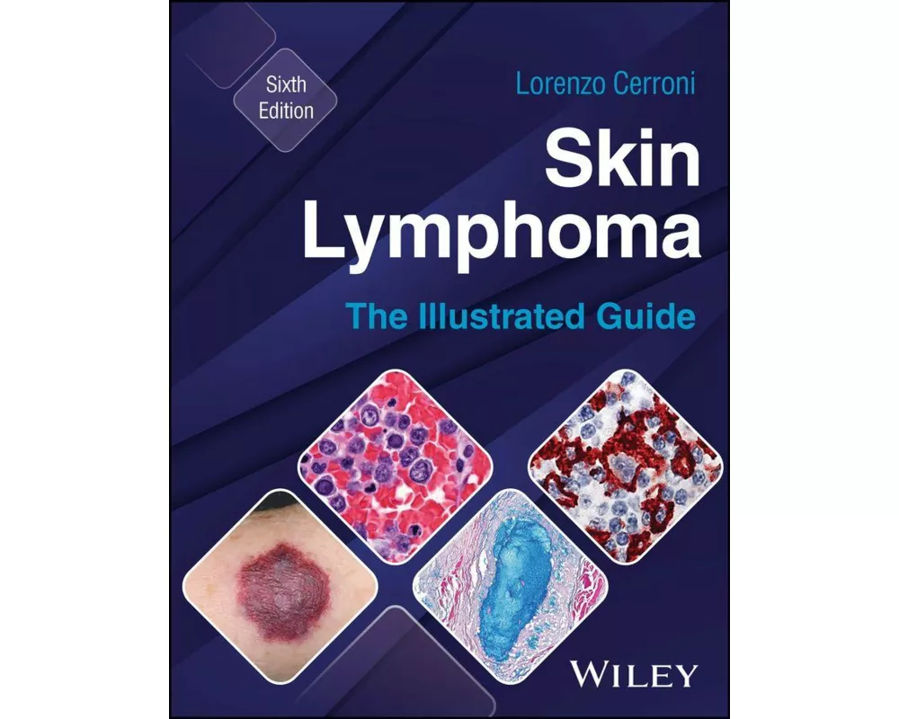 Skin Lymphoma