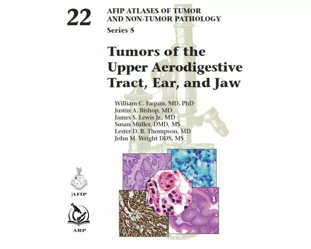 Tumors of the Upper Aerodigestive Tract, Ear, and Jaw