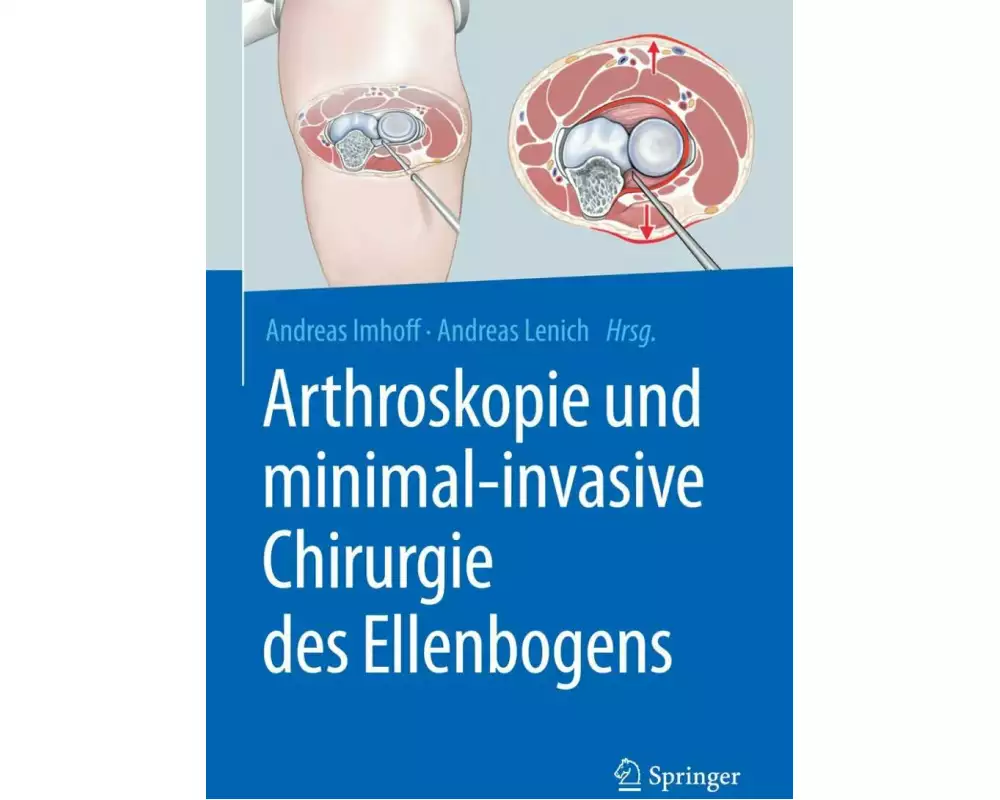 Arthroskopie und minimal-invasive Chirurgie des Ellenbogens