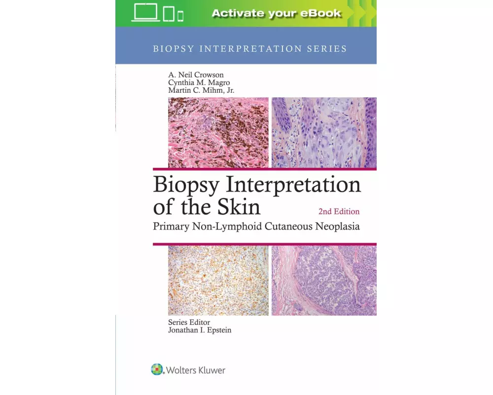 Biopsy Interpretation of the Skin