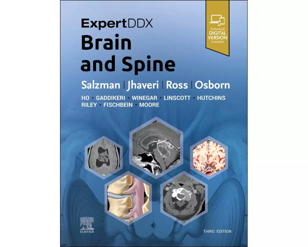 Expertddx: Brain and Spine