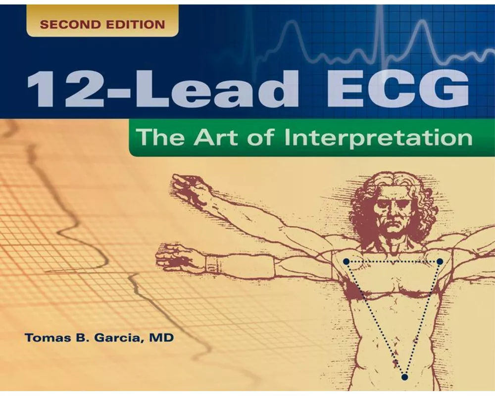 12-Lead ECG: The Art Of Interpretation