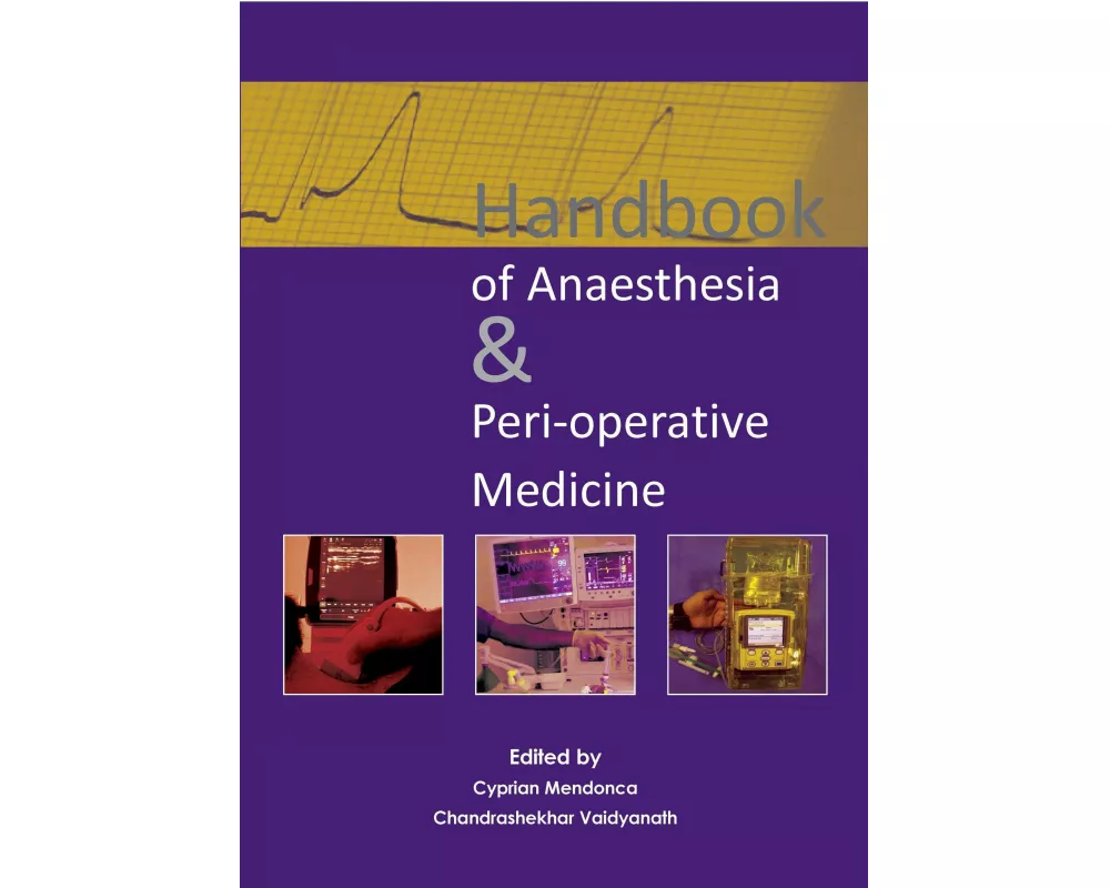 Handbook of Anaesthesia & Peri-Operative Medicine