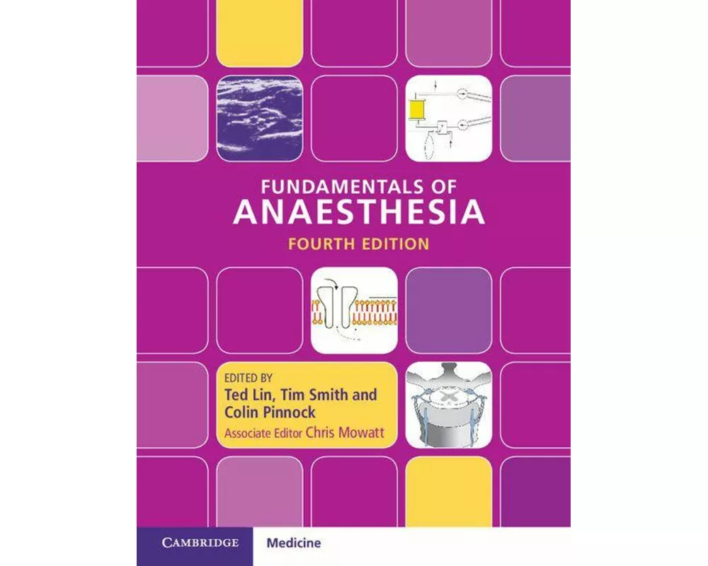 Fundamentals of Anaesthesia