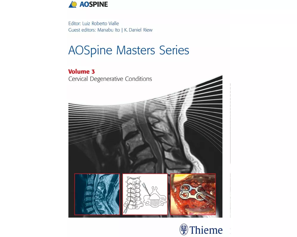 AOSpine Masters Series Volume 3: Cervical Degenerative Conditions