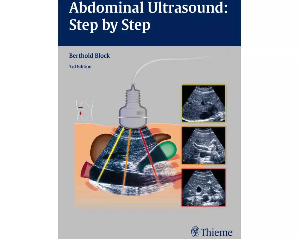 Abdominal Ultrasound: Step by Step