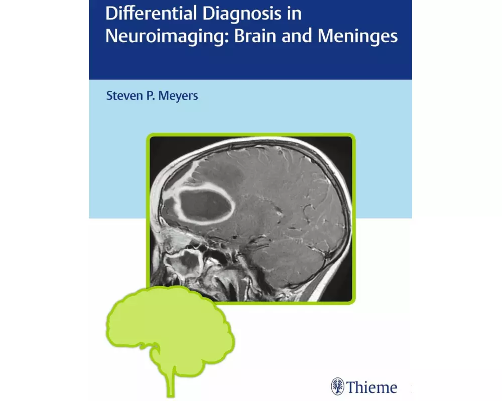 Differential Diagnosis in Neuroimaging: Brain and Meninges