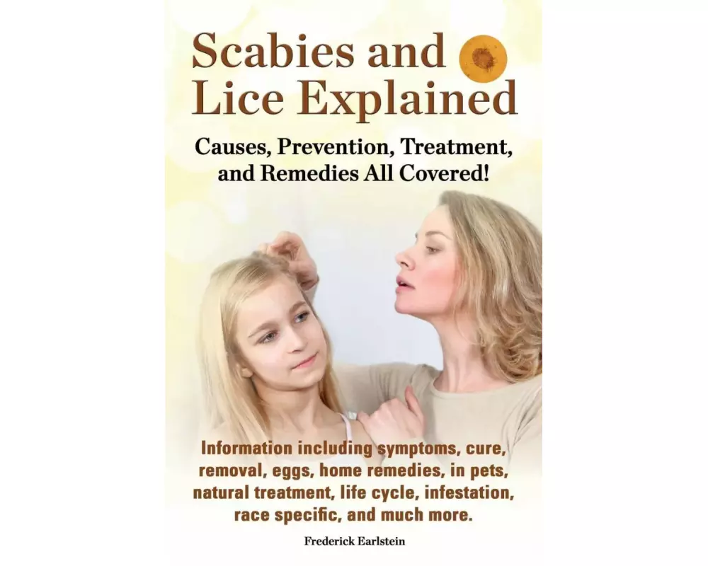 Scabies and Lice Explained. Causes, Prevention, Treatment, and Remedies All Covered! Information Including Symptoms, Removal, Eggs, Home Remedies, in