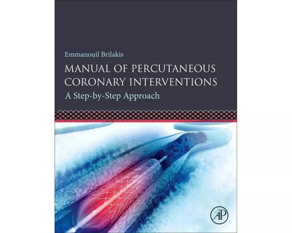 Manual of Percutaneous Coronary Interventions
