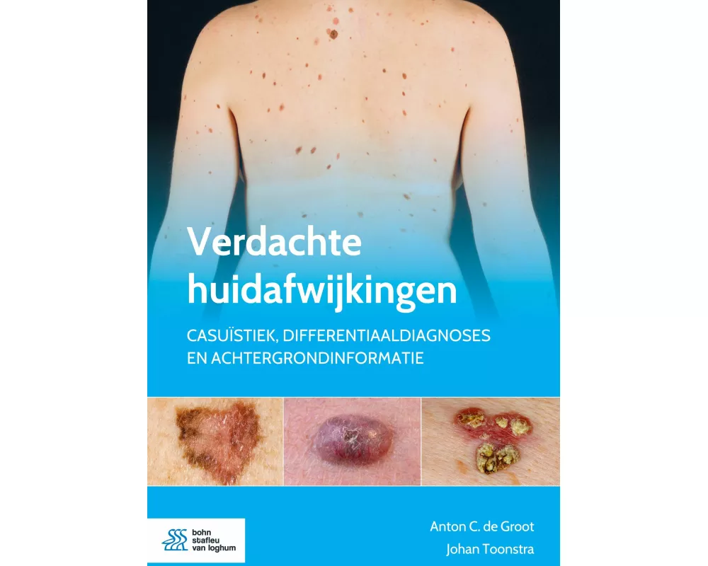 Verdachte Huidafwijkingen